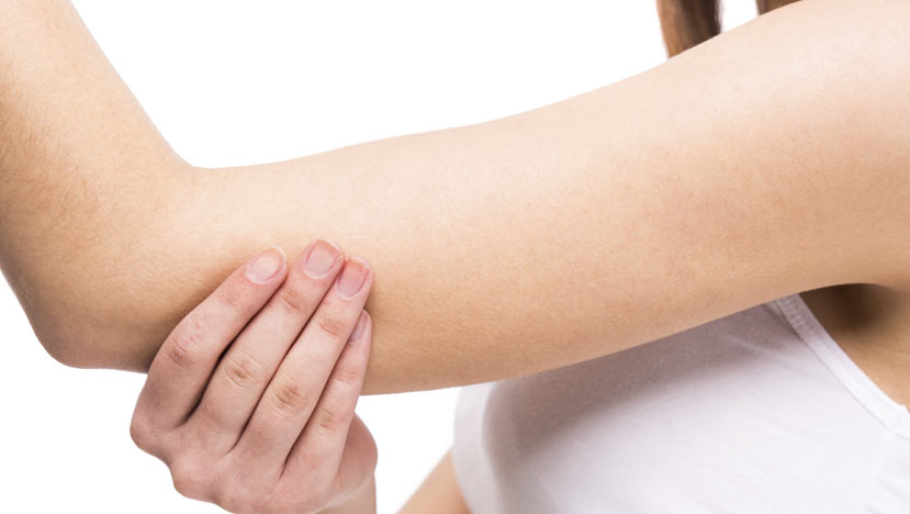 Woman holding arm due to Cubital Tunnel Syndrome