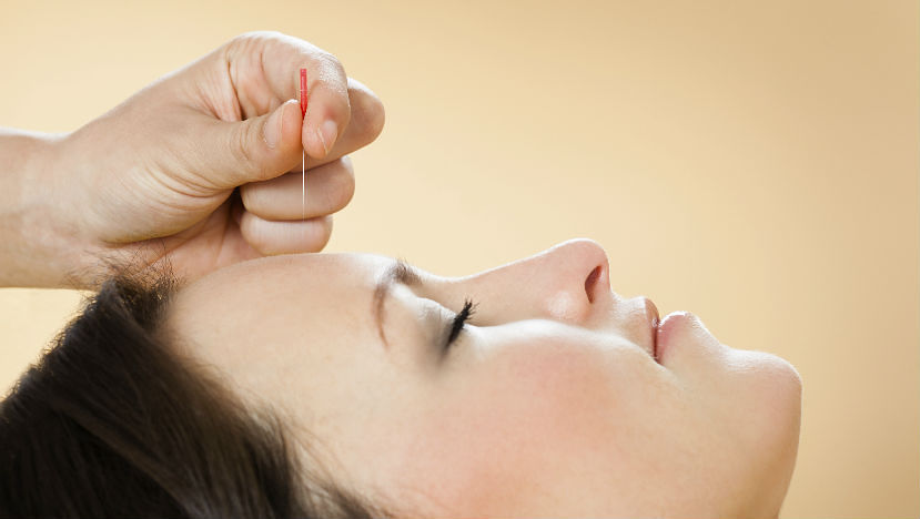 Acupuncture How It Works And What Happens