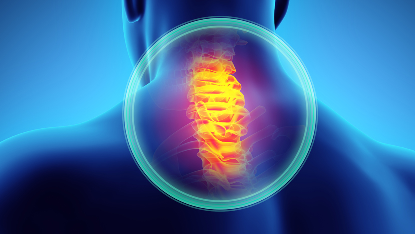 Cervical Spine Fusion